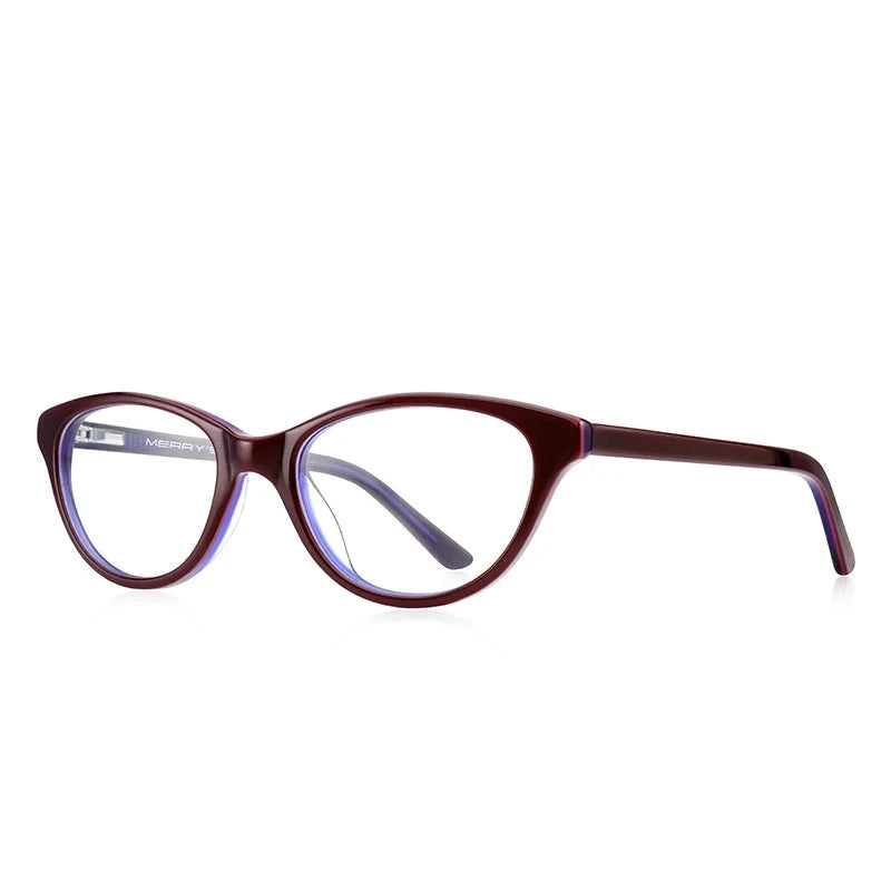 Kid's Cat Eye Acetate Frame Light Blocking Trendy Computer Glasses